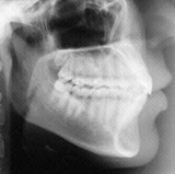 Radiologia Odontológica em Ribeirão das Neves